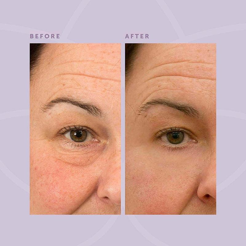 Liquid Miracle Instant Facelift