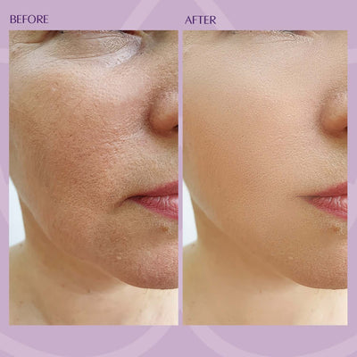 Beverly Hills Pro-Retinol 2% Serum, 30ml