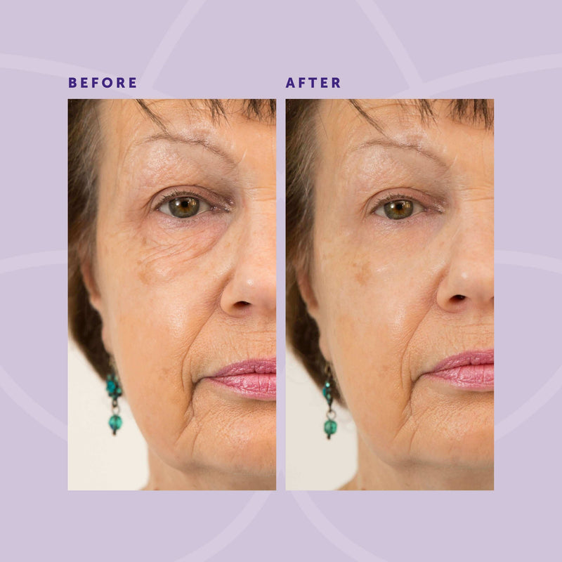 Liquid Miracle Instant Facelift