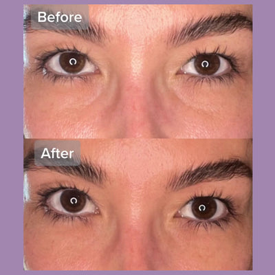 Beverly Hills V-Lift Instant Facelift & Under Eye Tuck 30ml (1 fl oz)